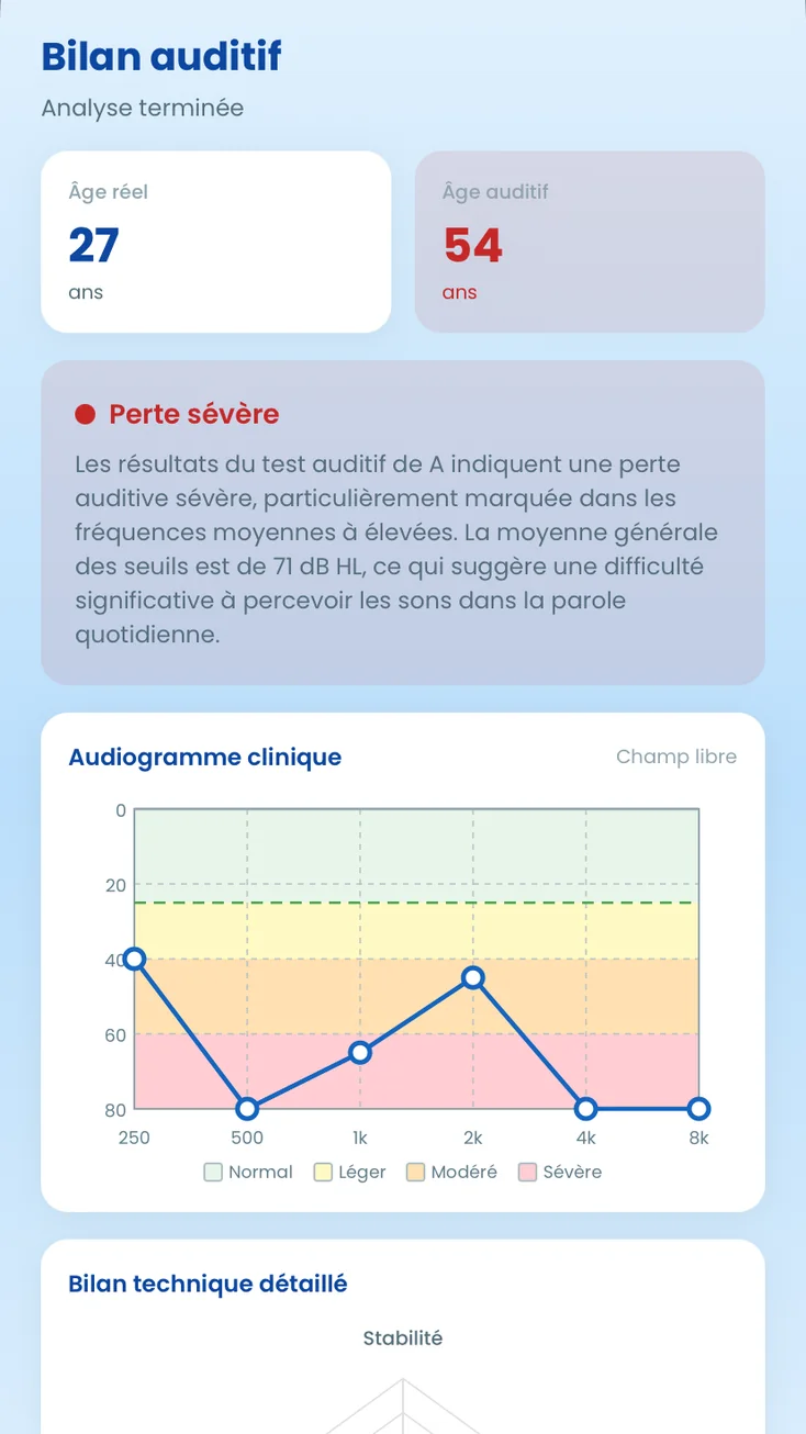 AudiCheck, le bilan refait&nbsp;: fond ciel, explication du résultat et audiogramme en couleurs.